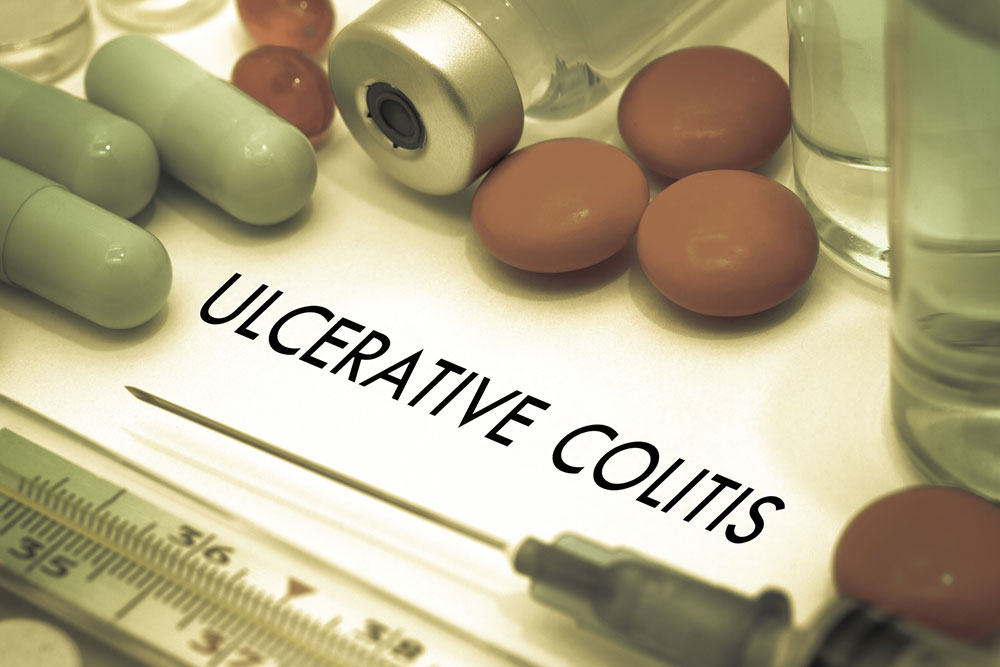 8 dietary do’s and don’ts for ulcerative colitis