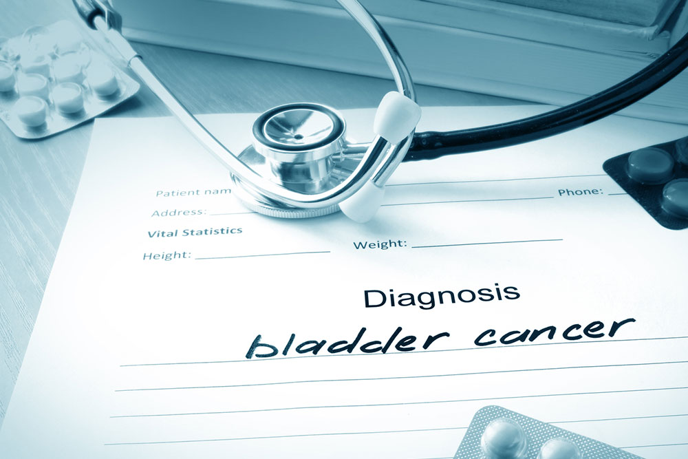 Common Treatment Options for Bladder Cancer