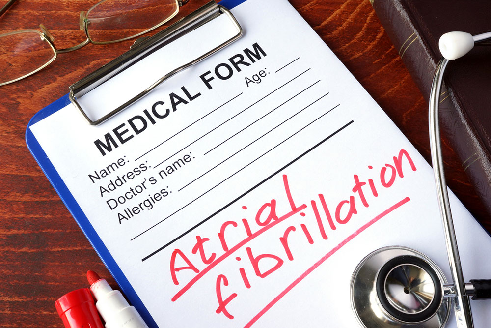 Causes, symptoms, and diagnosis of atrial fibrillation