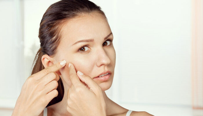 Causes of facial wrinkles