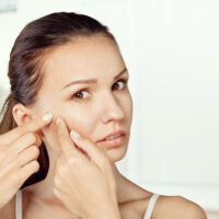 Causes of facial wrinkles