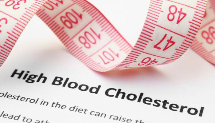 Everything you need to know about high cholesterol