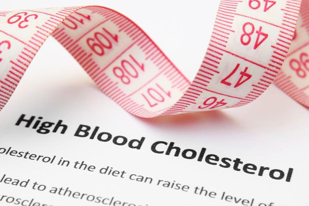 Everything you need to know about high cholesterol