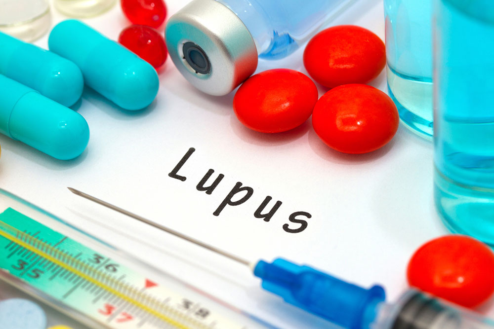Important facts that you need to know about Lupus