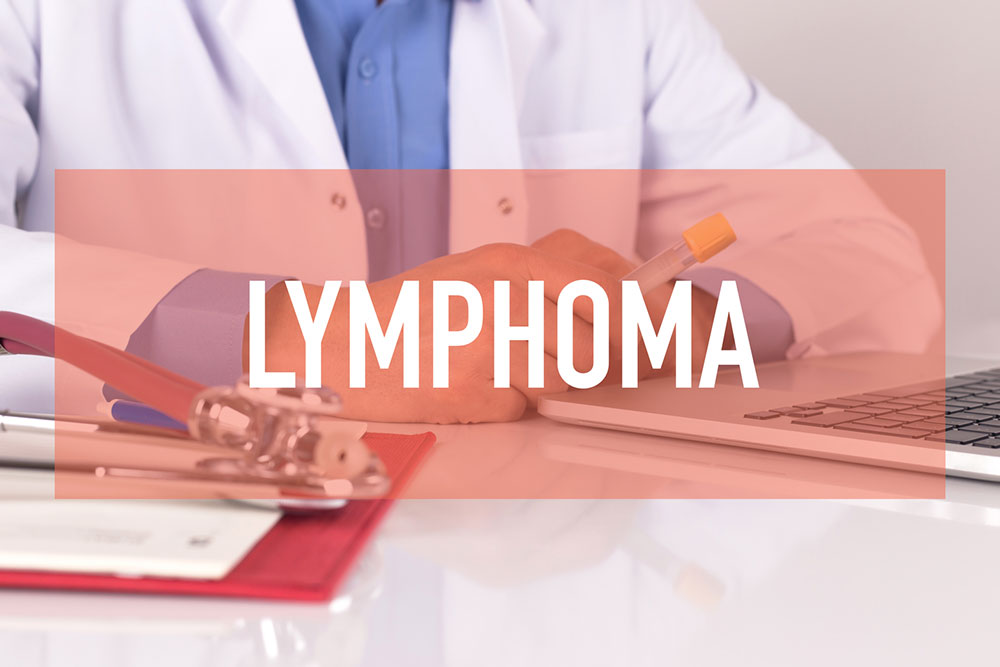 Lymphoma: Main Causes and Types