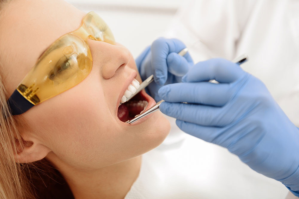 Top 3 fillings used for cavities