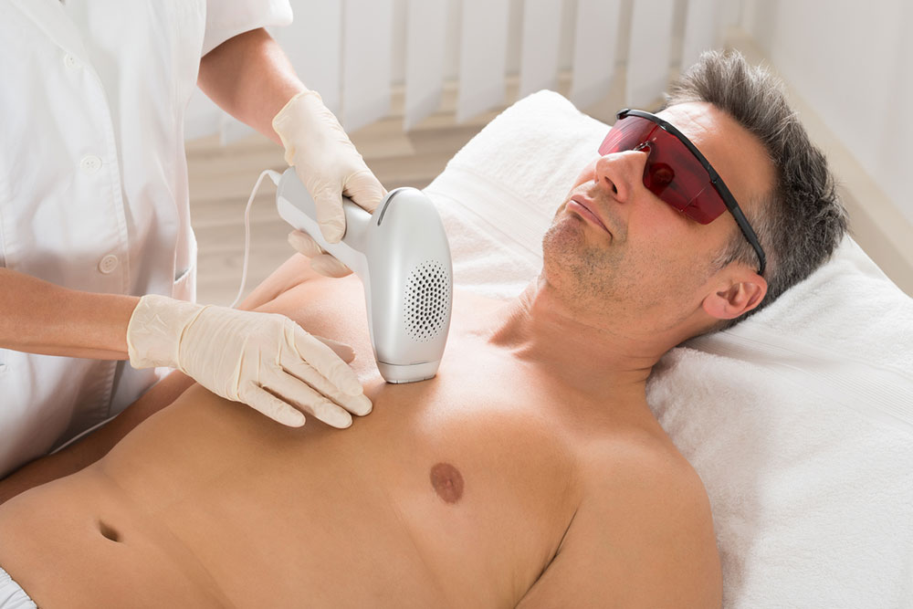 The Most Effective Hair Removal Treatments for Men