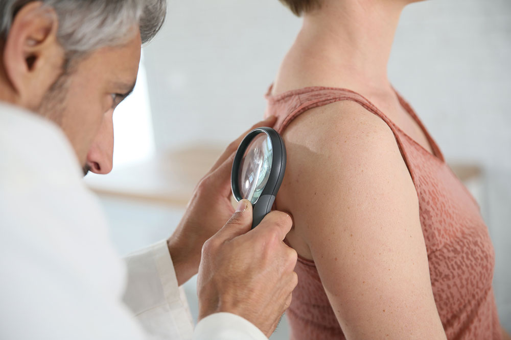 The risk factors of melanoma