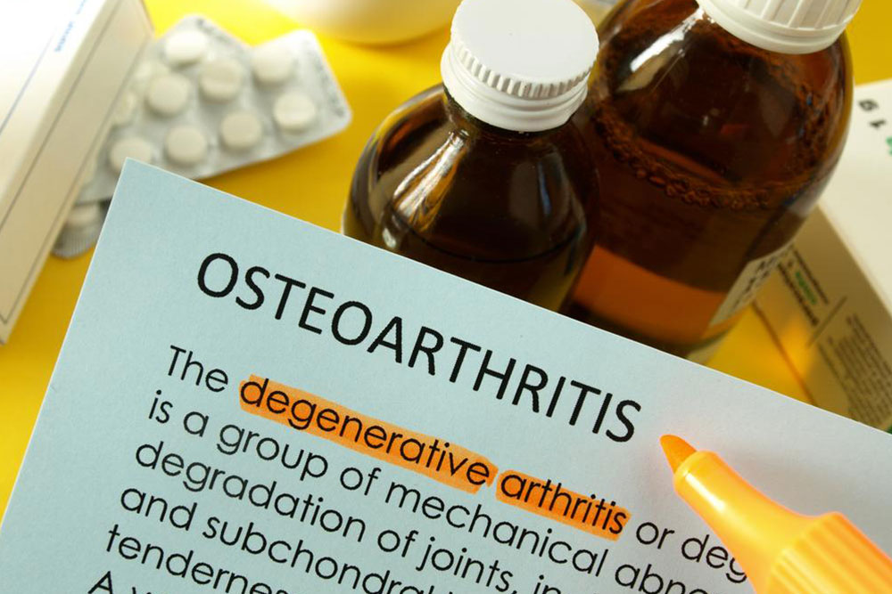 Treatment options available for osteoarthritis