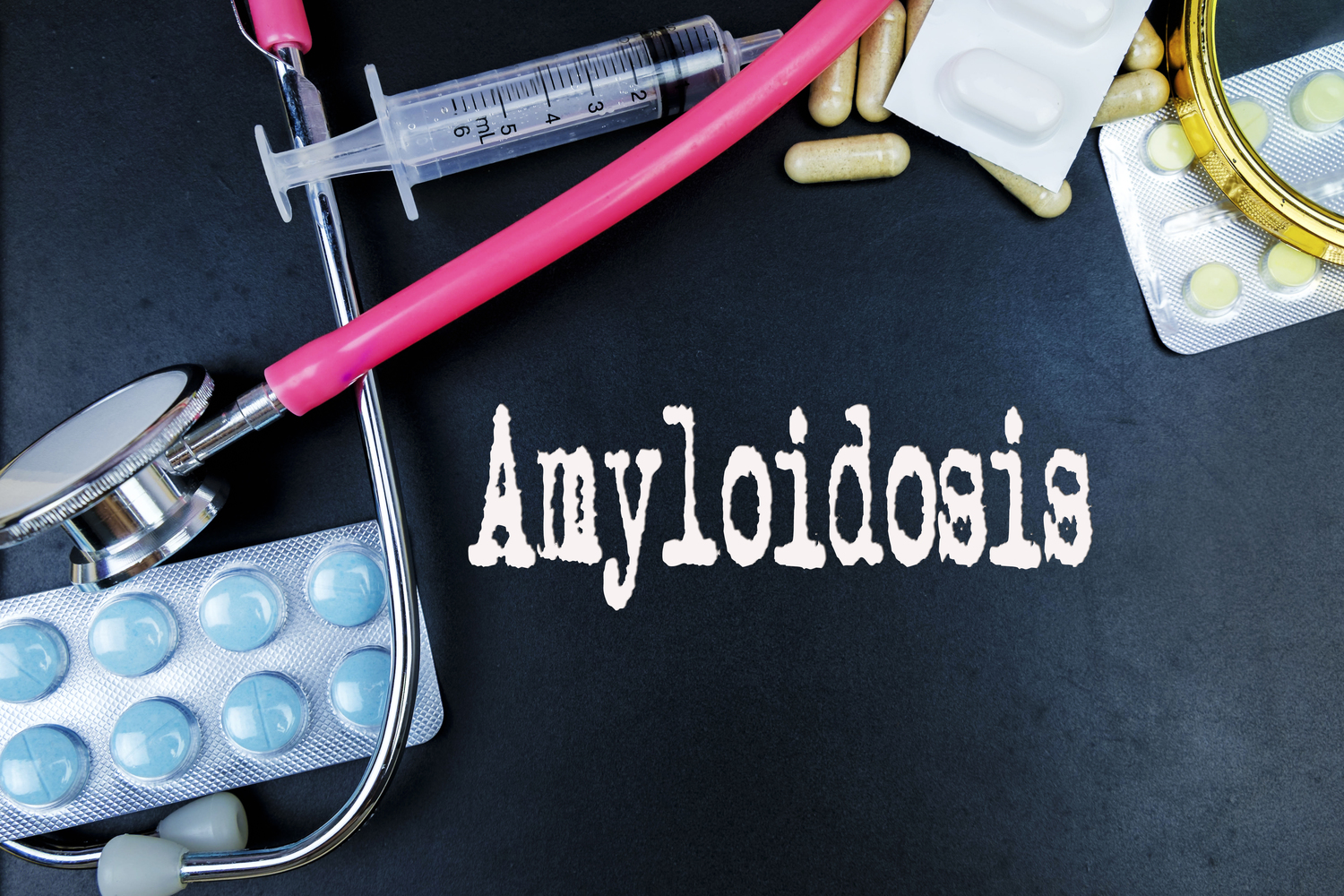 The Top Risk Factors for Amyloidosis