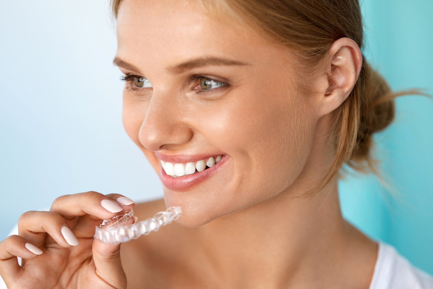 Why Choose Clear Aligners to Straighten Teeth?
